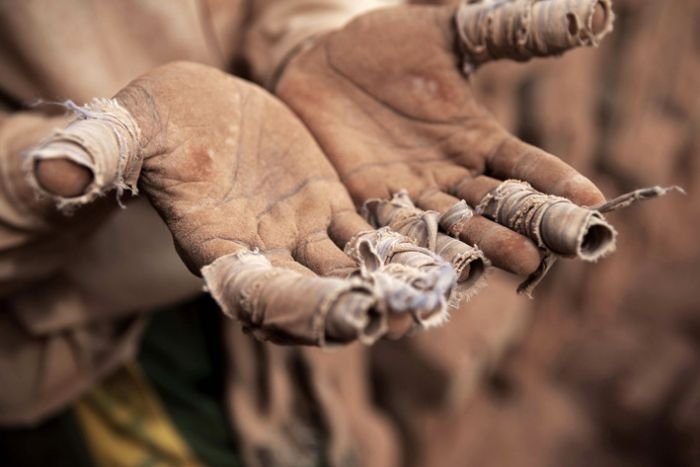 Brickworks hell in Bangladesh